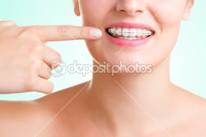 depositphotos_50128361-Braces